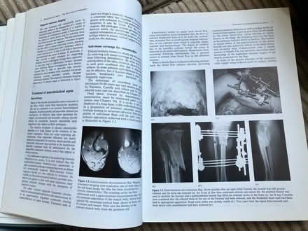 Photo of free Infection in the Orthopaedic Patien (TN35 Ore) #3