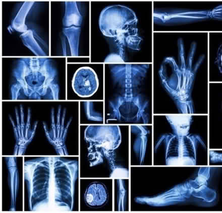 Photo of Any old X-rays for a crafty project (Orrell, wigan, WN5) #1