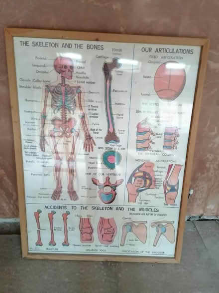 Photo of free anatomy picture and frame (Harrogate HG1) #2