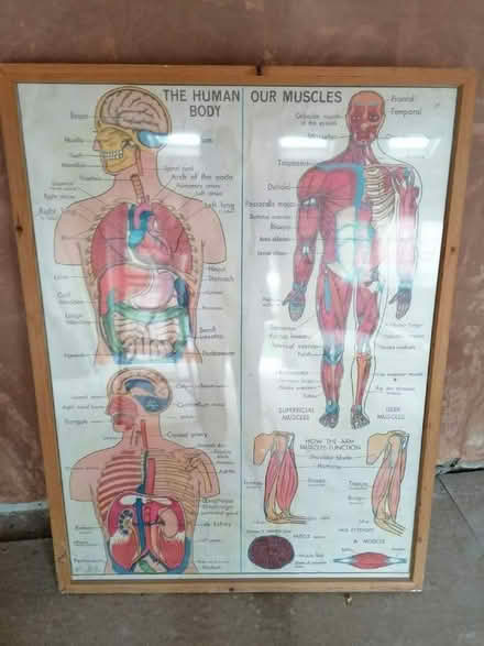 Photo of free anatomy picture and frame (Harrogate HG1) #1