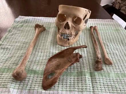 Photo of free Scull and bones (Braughing SG11) #1