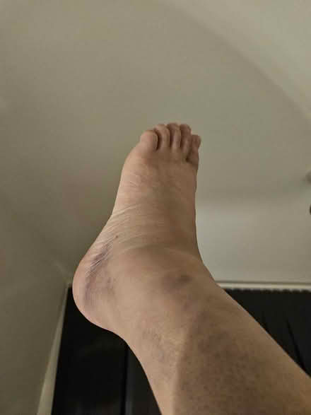 Photo of Crutches/moon boot (E5) #1