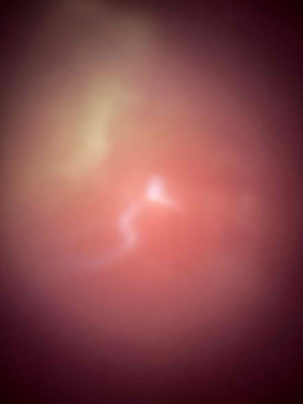 Photo of free Pot holders (Dalkey) #2