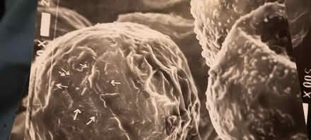 Photo of free plant cell electron micrographs (melrose) #2