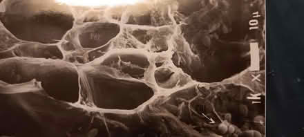 Photo of free plant cell electron micrographs (melrose) #3