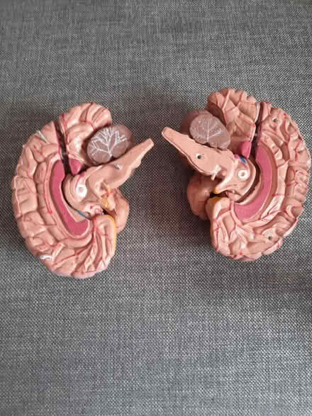 Photo of free Brain model 3D (Greenwich, SE10) #2